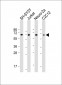 COL8A2 Antibody (C-term)